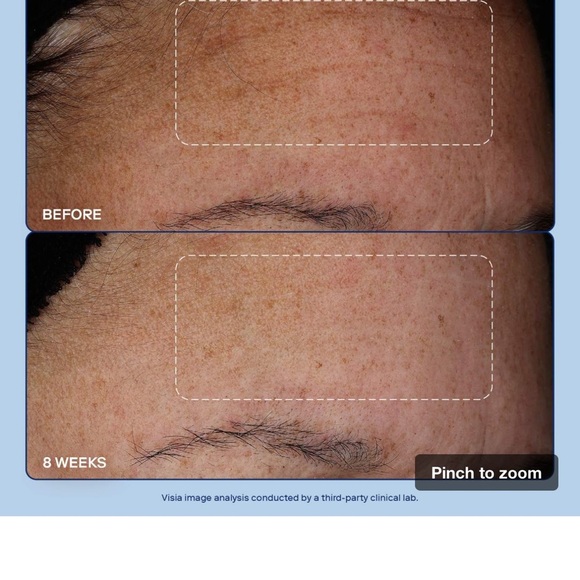 Skinfix Barrier+ Skin Cream - Picture 7 of 7